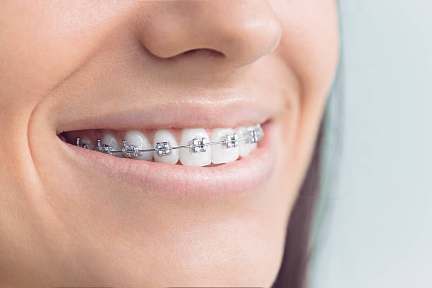 Best Dental Fillings (Composite and Amalgam)  in Garden Acres, CA